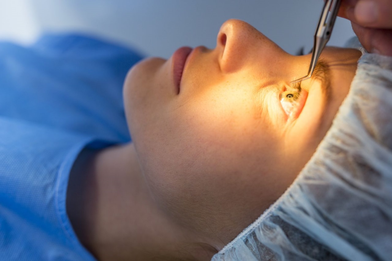 Why Lasik Istanbul Cost Is More Budget-Friendly Than Europe or USA